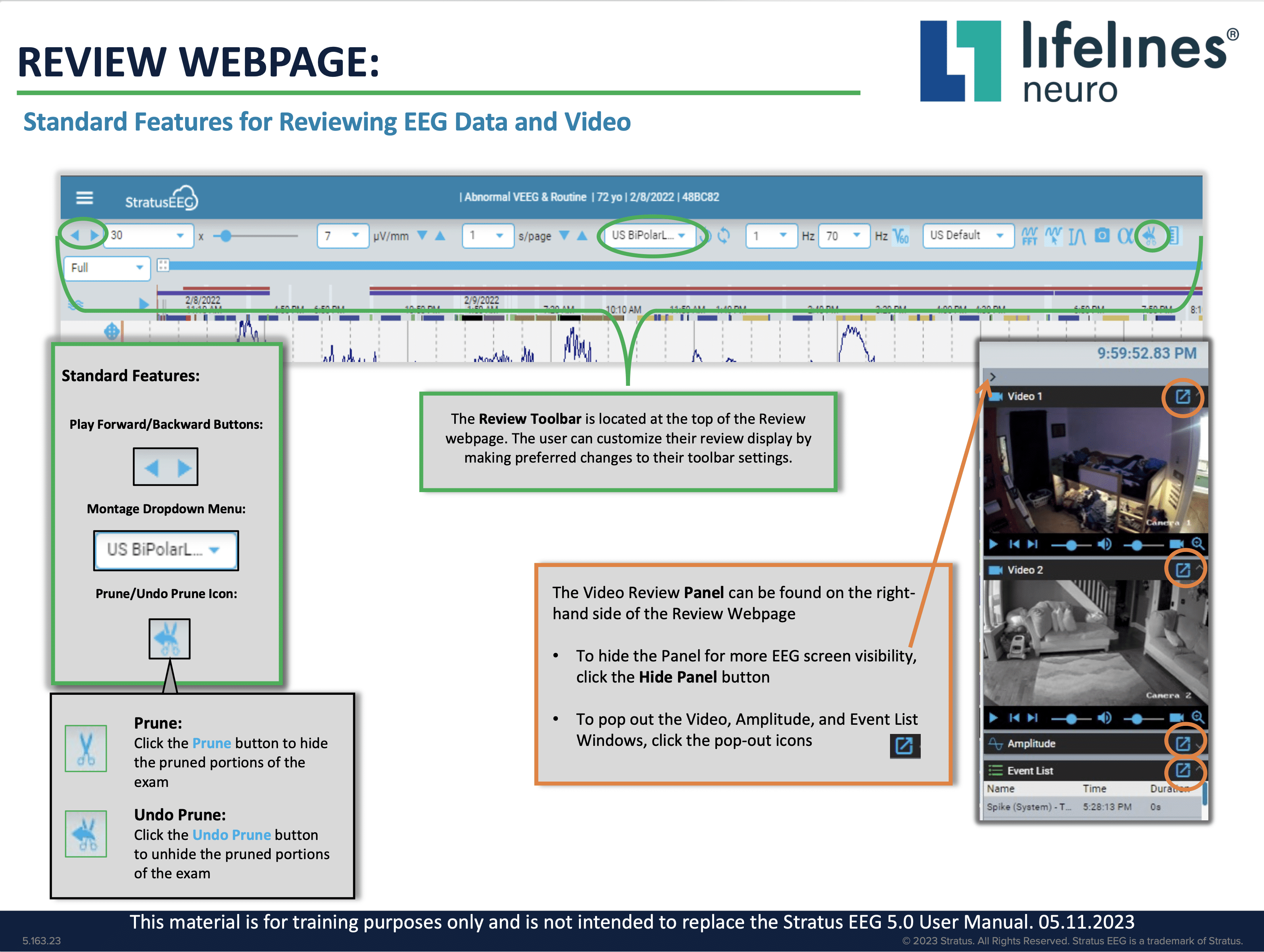 Review EEG & Video Review EEG & Video